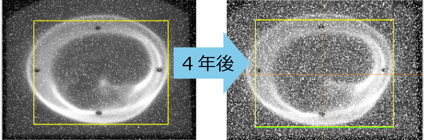 図1: 放射線によるビームモニターのCCDダメージの例